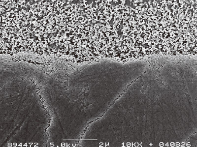 [写真] トライエスボンドのヒトエナメル質とのアルゴンイオンエッチングを施した接合界面の様相のSEM像（×10,000）