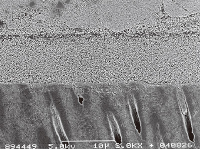 [写真] トライエスボンドのヒト象牙質とのアルゴンイオンエッチングを施した接合界面の様相のSEM像（×3,000）