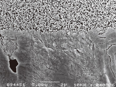 [写真] トライエスボンドのヒト象牙質とのアルゴンイオンエッチングを施した接合界面の様相のSEM像（×10,000）