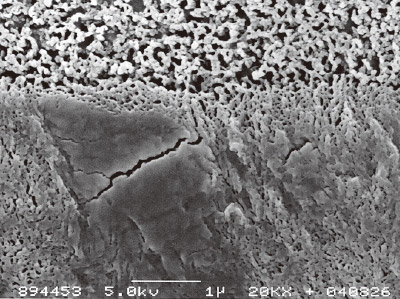 [写真] トライエスボンドのヒト象牙質とのアルゴンイオンエッチングを施した接合界面の様相のSEM像（×20,000）