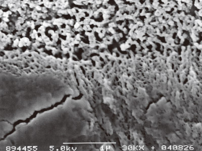 [写真] トライエスボンドのヒト象牙質とのアルゴンイオンエッチングを施した接合界面の様相のSEM像（×30,000）