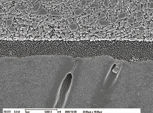ハイブリッドコートⅡと正常象牙質との接合界面のSEM像（ｘ5,000）