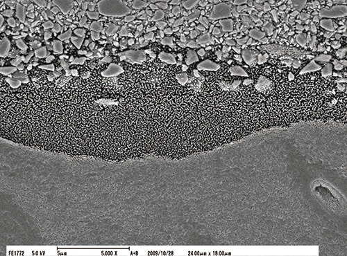 う蝕象牙質第２層（CAD）と硬化したハイブリッドコートⅡとの接合界面のSEM像（ｘ5,000）