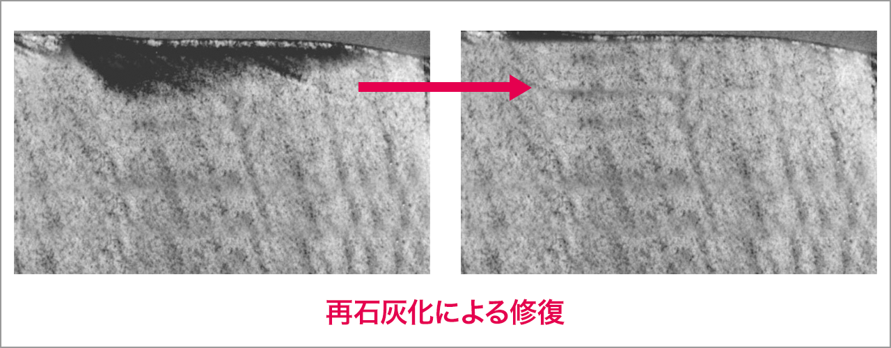 図1 初期う蝕（表層化脱灰）のin vitro再石灰化像