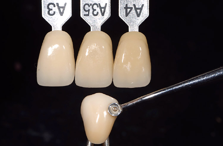 図16　歯冠の広範囲にわたって色調調整するときは、CZR-EグレーズとCZRプレスLFエクスターナルステインを混和すれば比較的色ムラが少ない。練和粘度はハチミツ程度が塗布しやすい（ISリキッド使用）。