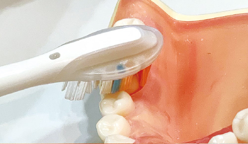 [写真] ポケット部分や歯間部以外の歯面や咬合面はブラシの中央部分を使ってブラッシングする