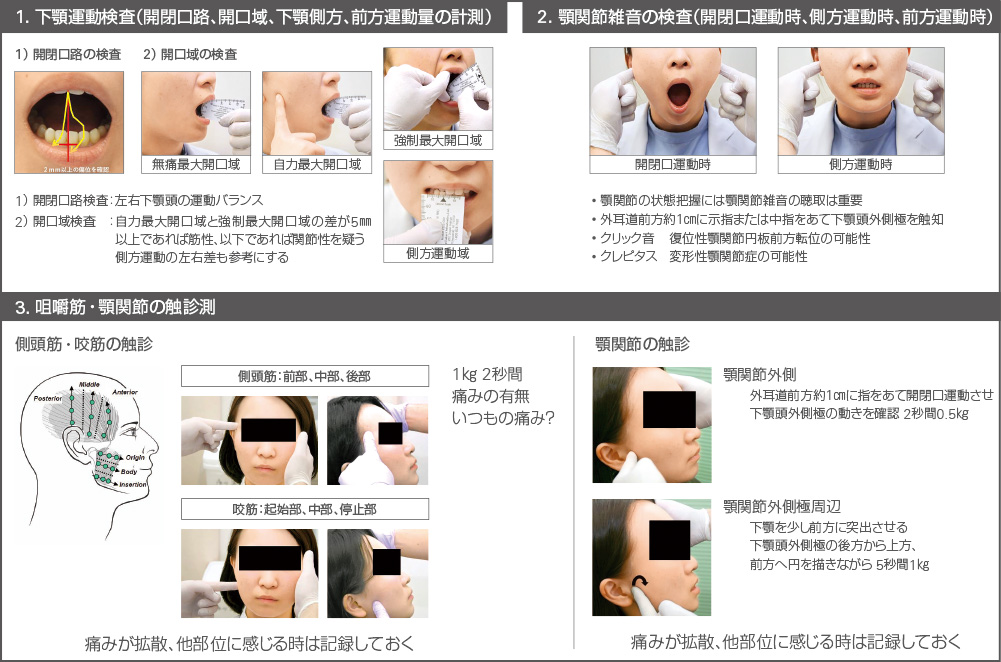 [図] 顎関節症検査（日本顎関節学会編 顎関節症治療の指針2020より）